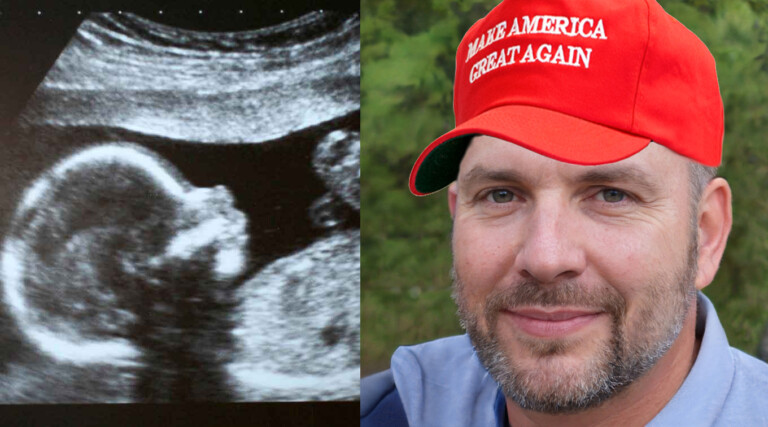 Texas Man Thinks Wife’s OB is a Groomer Because They Couldn’t Find the Fetus’s Genitals